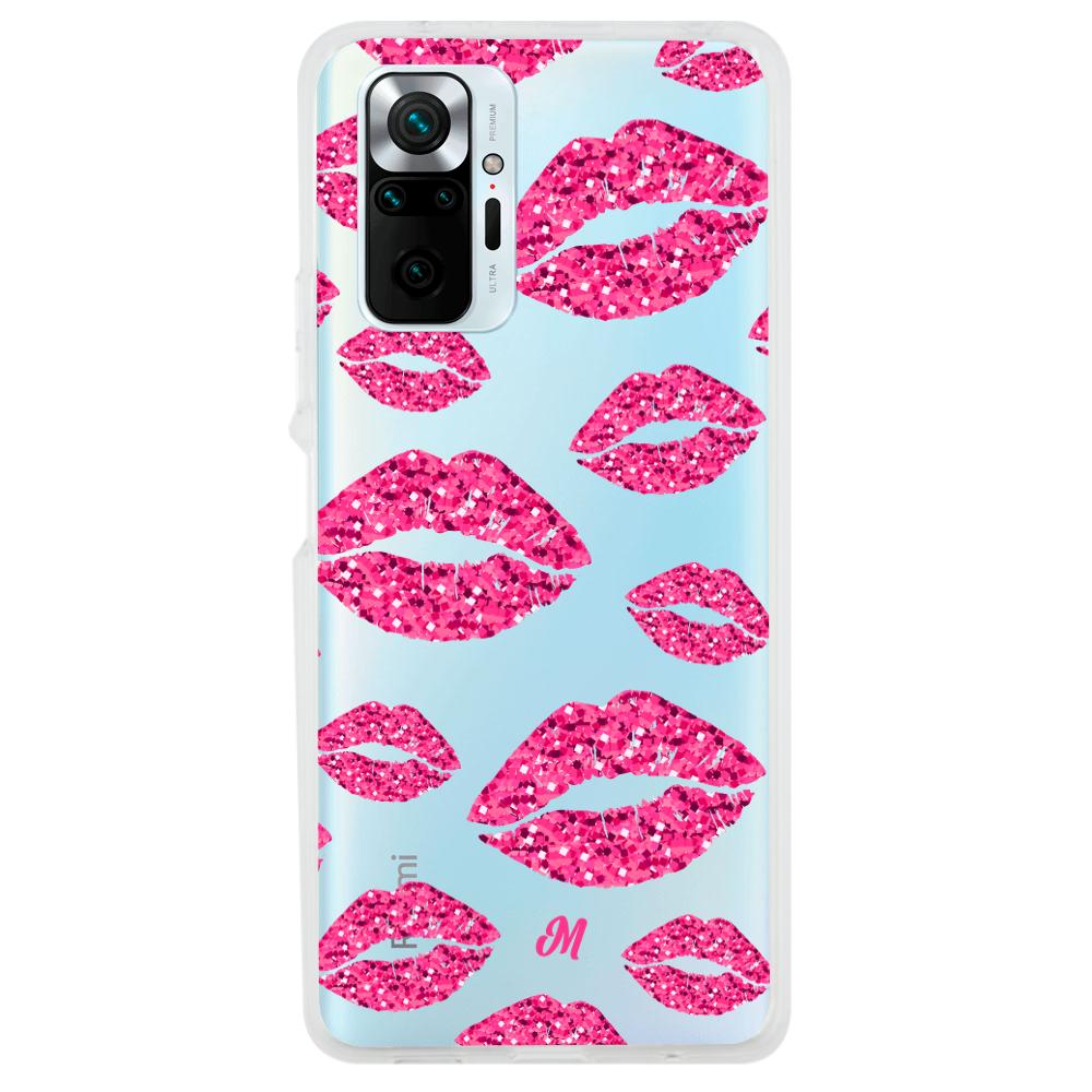 Case para Xiaomi Redmi note 10 Pro Glitter kiss - Mandala Cases