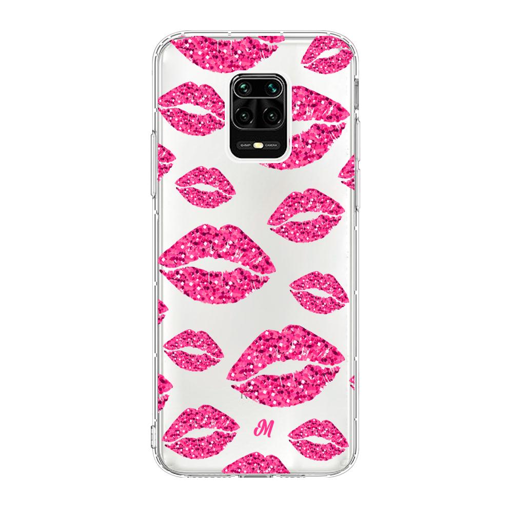 Case para Xiaomi redmi note 9s Glitter kiss - Mandala Cases